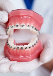 an orthodontist holding a model of braces near Joshua