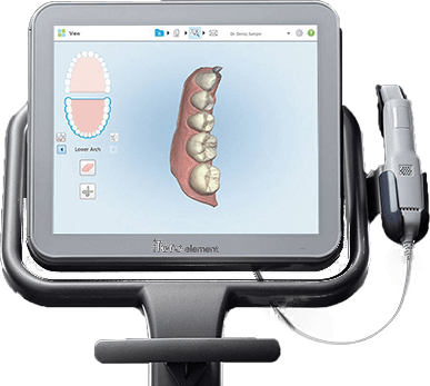 3d digital impressions on computer