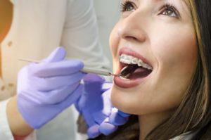 woman smiling wearing braces