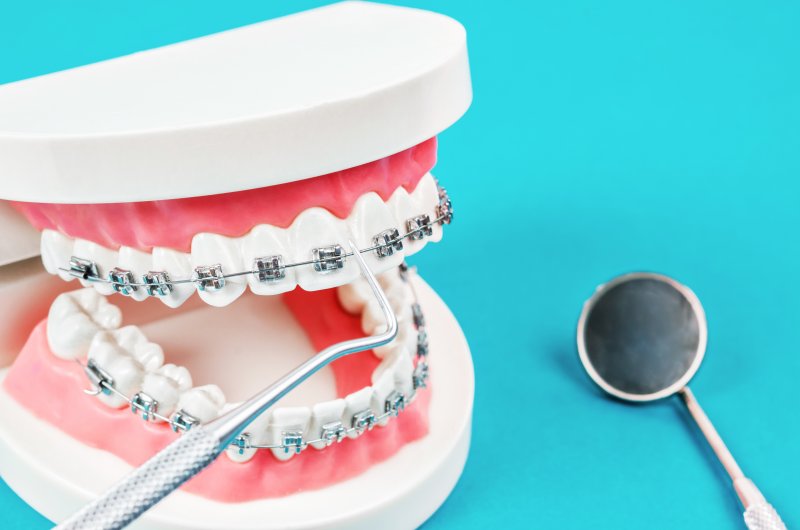 a mouth mold wearing metal braces and dental tools nearby