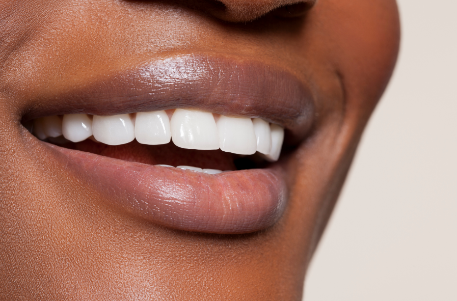 Close up of woman's smile
